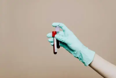 Amylase (Blutwert): Was bedeutet das Enzym für die Gesundheit? 7 "Ein medizinischer Handschuh hält ein Blutteströhrchen für die Amylase-Blutwert-Bestimmung"